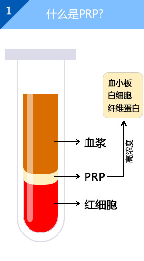 什么是PRP?