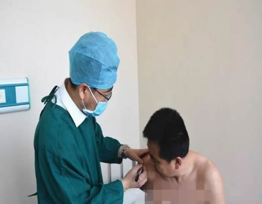 打一针PRP 摆脱多年肩关节疼痛困扰