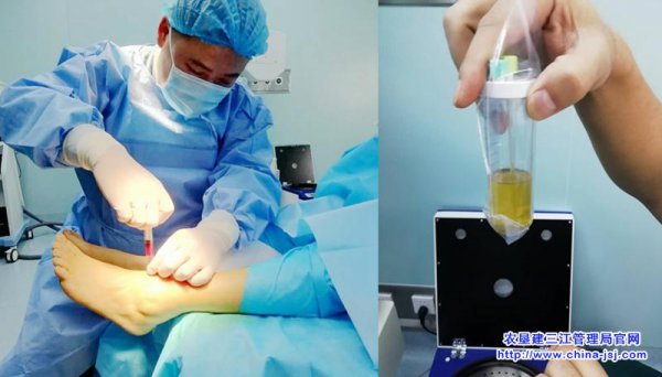 建三江人民医院骨科成功开展富血小板血浆自体修复术