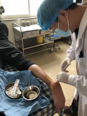 神奇！抽自体血能治关节痛3倍以上血小板，加速组织修复和再生