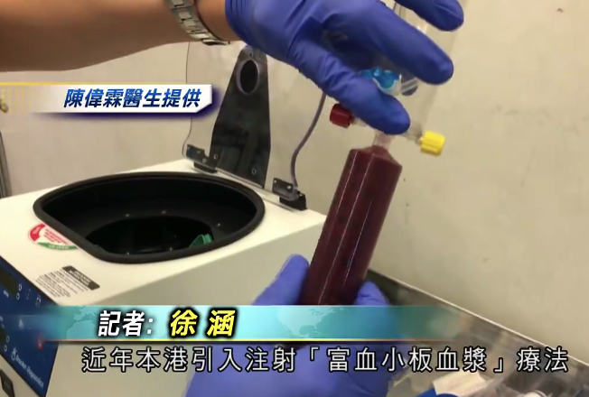 医疗：膝盖筋腱发炎患处注射富血小板血浆可加快复原