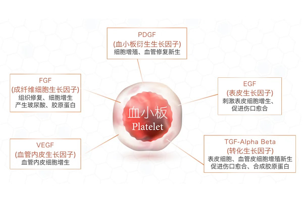 富血小板血浆PRP在运动医学运用及注意事项