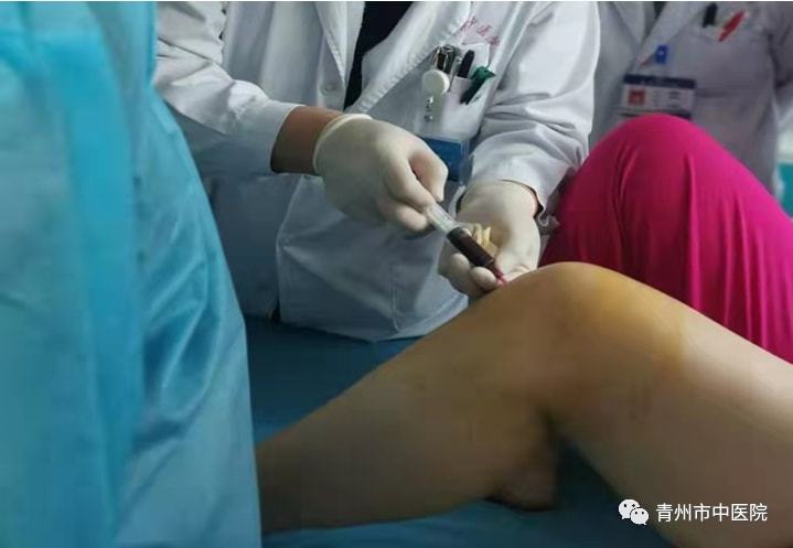 青州市中医院骨伤科成功完成青州市首例“PRP”注射治疗膝关节炎