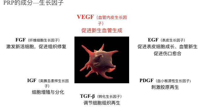 成功开展 “PRP”注射治疗腕关节创伤性关节炎2.png