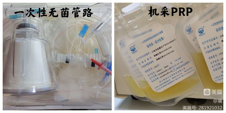 南华大学附属第一医院输血科新开展富血小板血浆(PRP)应用治疗项目-湖南-关节PRP网-致力于PRP(富血小板血浆)治疗关节疾病的推广工作