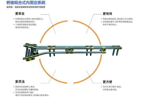 新疆医科大学第四附属医院骨四科成功开展首例桥接组合式内固定系统（OBS）治疗复杂肱骨干骨不连手术