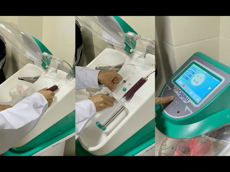PRP！亳州骨科医院又有新技术引进！