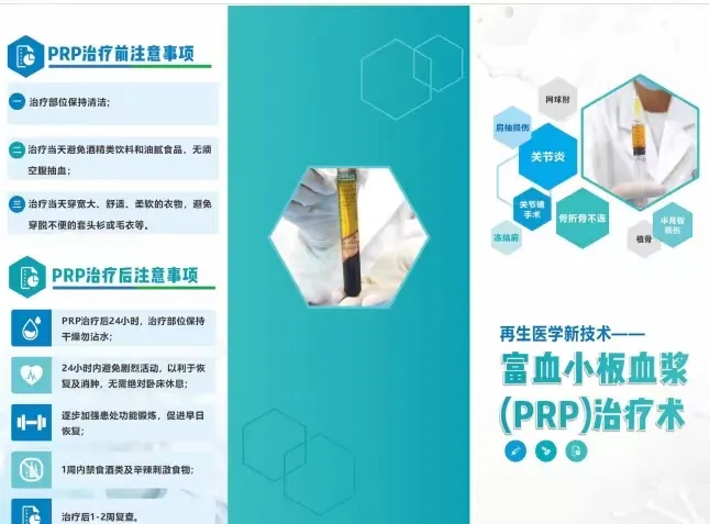 库车市人民医院将开展疼痛治疗新技术—富血小板血浆（PRP）治疗术