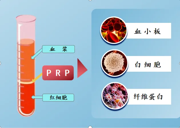 晋城大医院：神奇！用自己的血就能治关节炎？PRP疗法到底是什么？