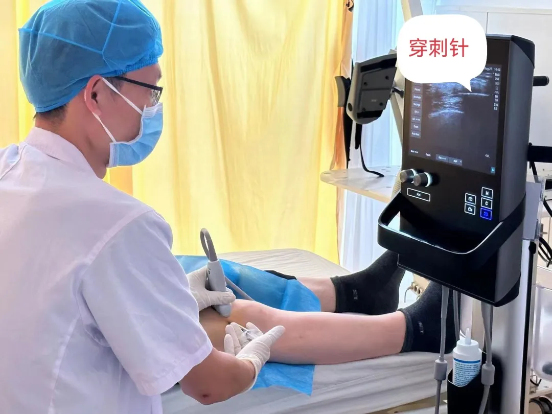 山东第二医科大学附属医院：关节疼痛患者的新希望-富血小板血浆（PRP）疗法