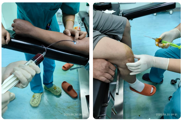 太原市万柏林区医疗集团中心医院：唤醒自身修复力 骨科带你了解神奇的PRP治疗