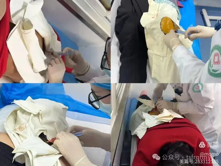 唐山市丰润区人民医院：疼痛患者的富含血小板血浆（PRP）治疗