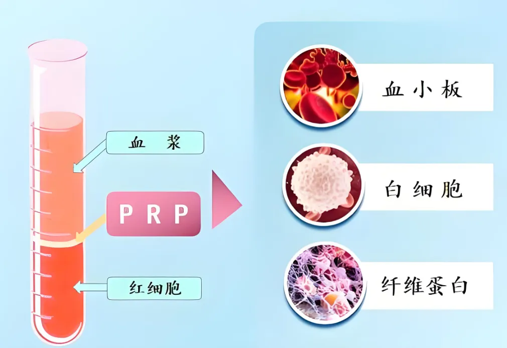 合肥中山医院：你的血液里，藏着修复关节的“密码”——PRP富血小板疗法