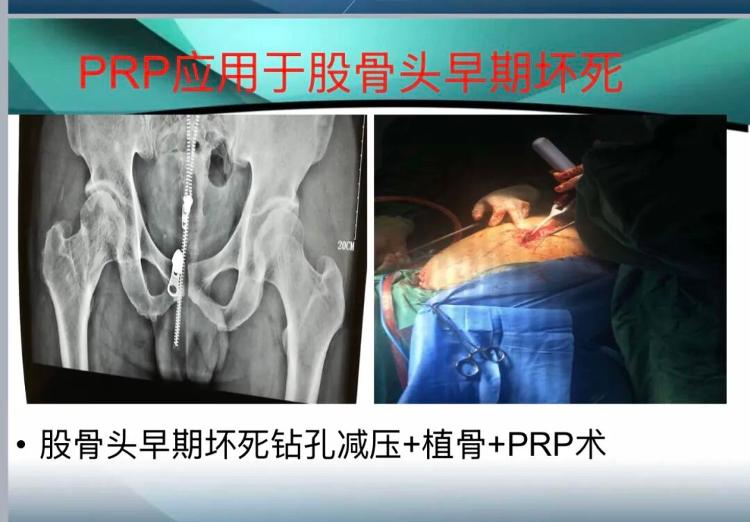 滨州市滨城区人民医院深耕再生医学 为患者铺就康复之路